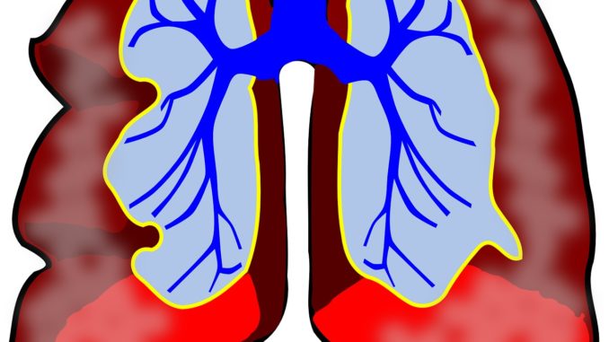 Asthma-Lungs Asthma