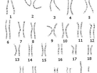 Chromosomes
